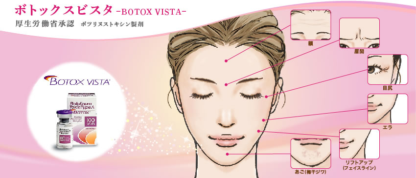 ボトックスビスタ-BOTOX VISTA-厚生労働省承認　ボツリヌストキシン製剤