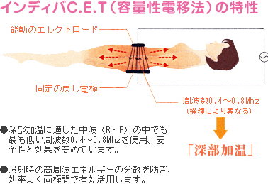 インディバC.E.T（容量性電移法）の特性