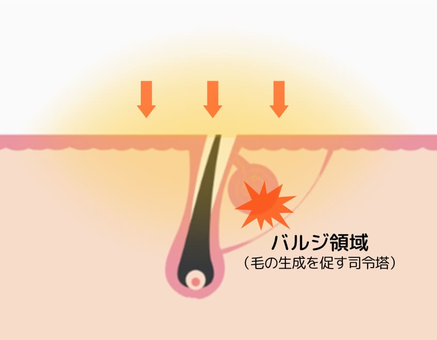 蓄熱式照射イメージ