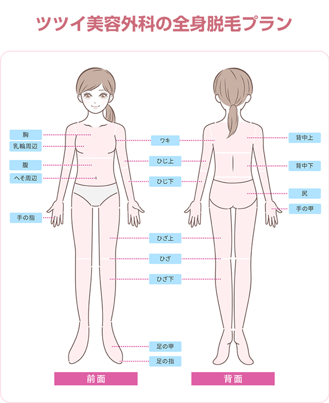 ツツイ美容外科の全身脱毛プラン