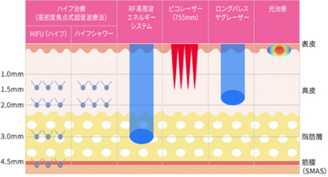 治療機器毎の比較図