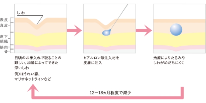 改善イメージ