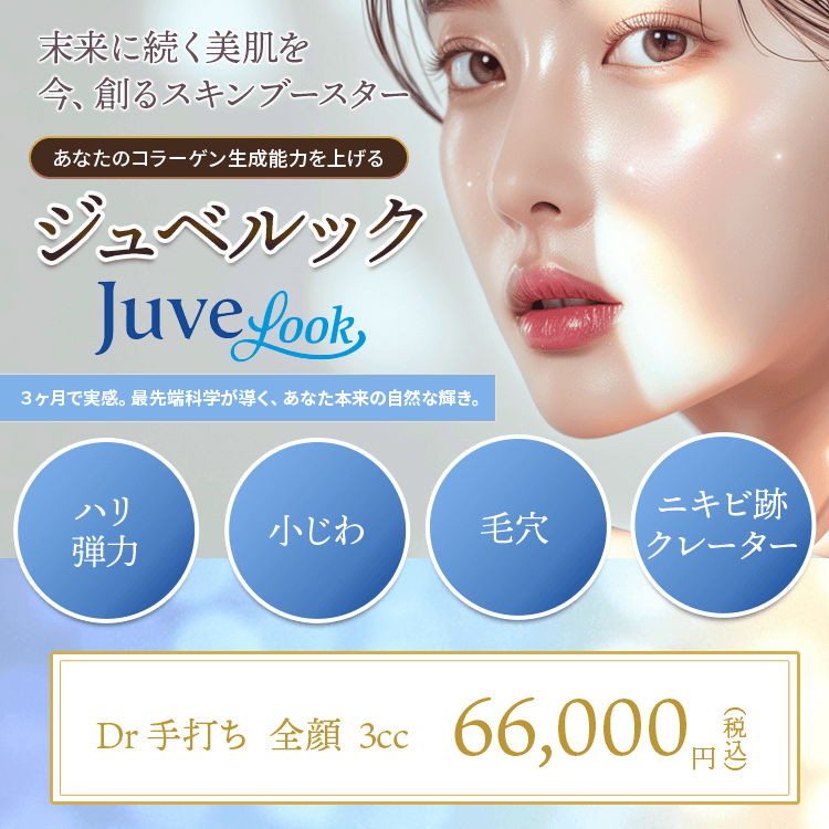 ジュベルック