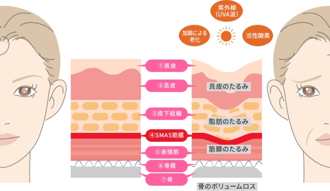 たるみができる原因やメカニズムのイメージ画像