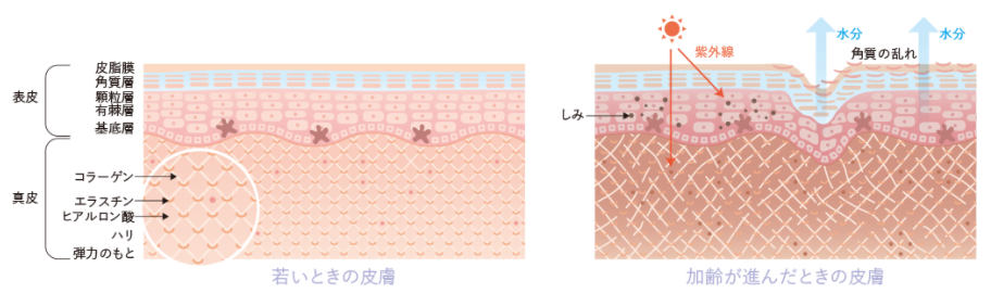 加齢による皮膚の変化のイメージ画像