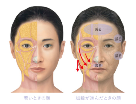 加齢による皮下組織（皮下脂肪・筋肉）の変化のイメージ画像