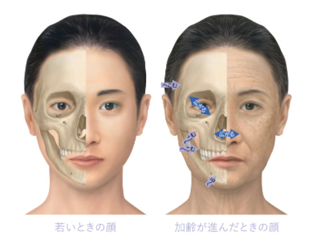 加齢による骨の変化のイメージ画像