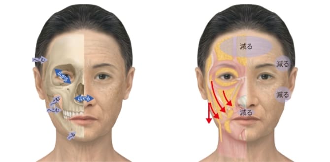顔の構造と老化のメカニズムに着目しながら治療