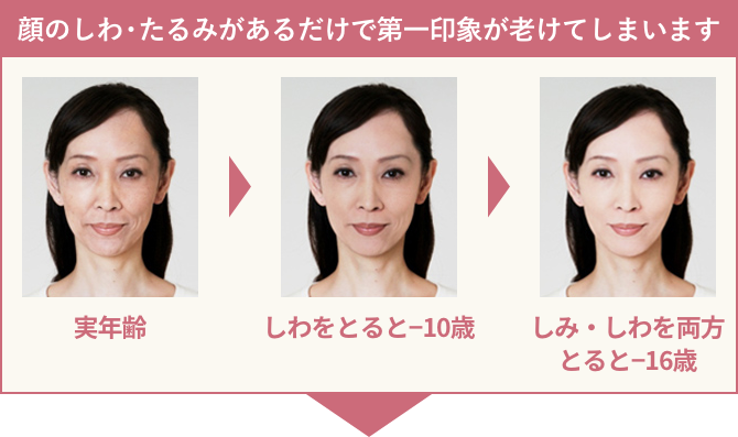 顔のしわ・たるみがあるだけで第一印象が老けてしまいます
