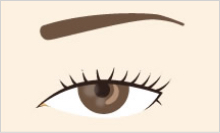 眼瞼下垂のイメージ画像