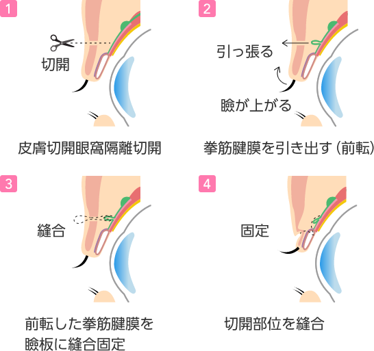 施術の流れ