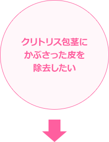 クリトリス包茎にかぶさった皮を除去したい