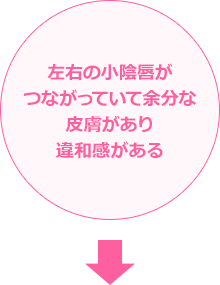 左右の小陰唇がつながっていて余分な皮膚があり違和感がある