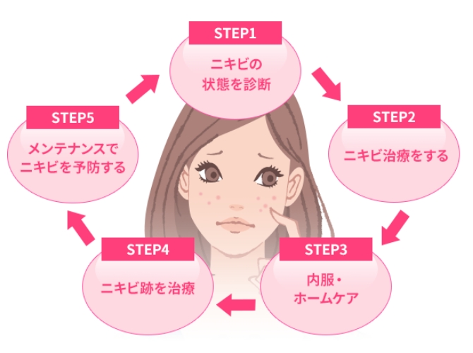 5つのSTEPのイメージ画像