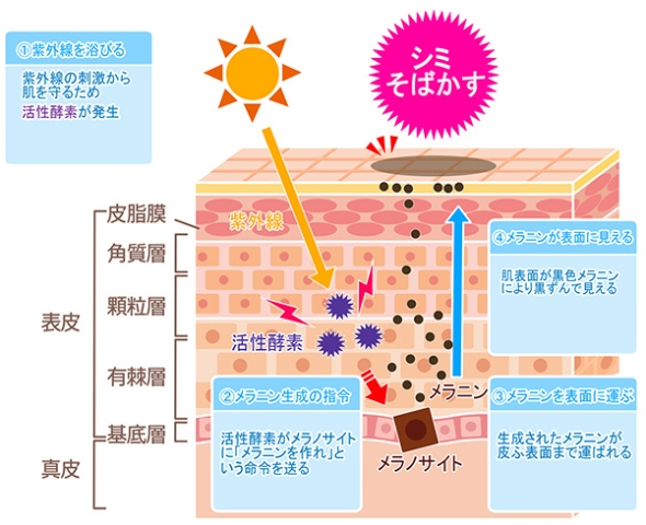 シミができる原因やメカニズムのイメージ画像