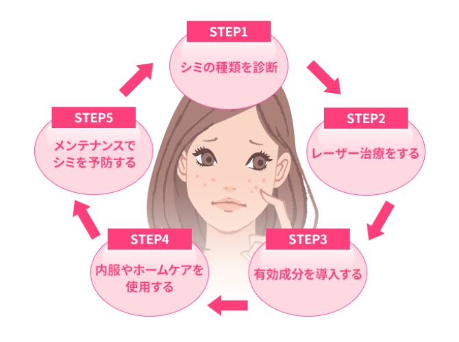 5つのSTEPのイメージ画像