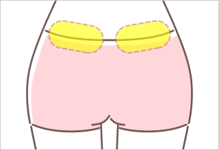 腰回り照射パターン