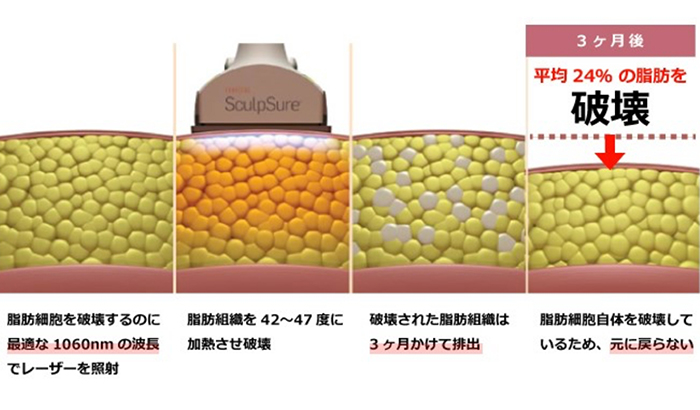 リバウンドの心配がない画像