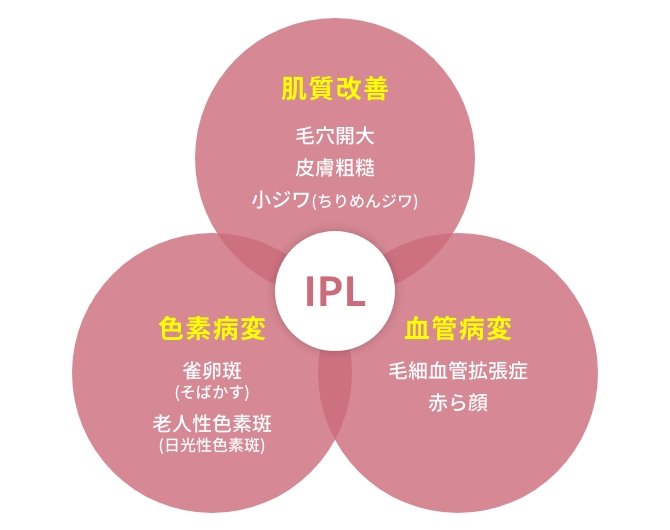 さまざまな波長を含んだ光により、シミ・くすみ・毛穴・赤ら顔・小ジワなど複合的な肌トラブルを改善します。