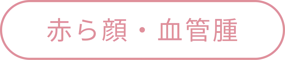 赤ら顔・血管腫