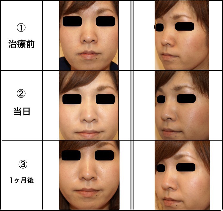 S__12165148