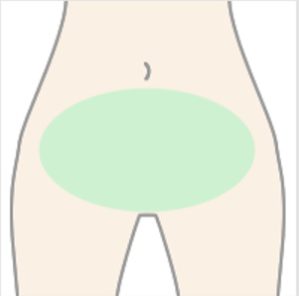 ハイジニーナ