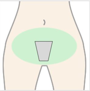 □