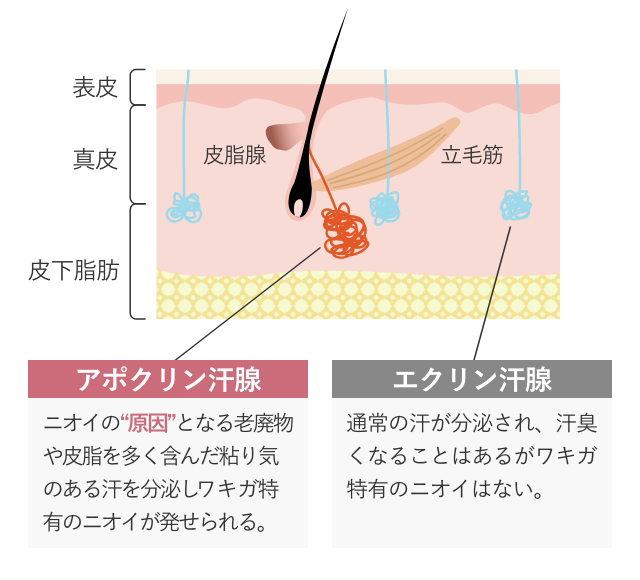 脇ボトックス