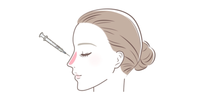 ヒアルロン酸注入(鼻)