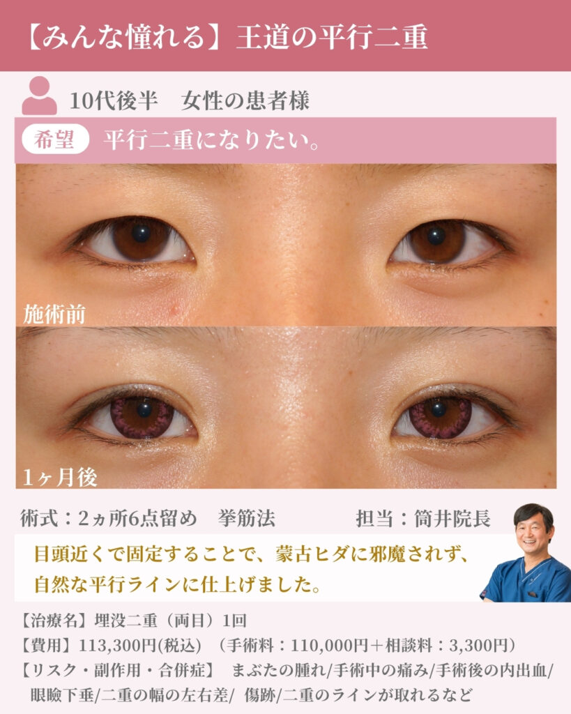 王道の平行二重