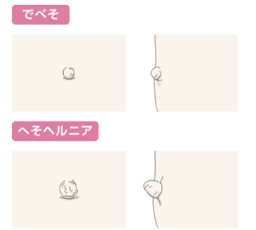 へその形成