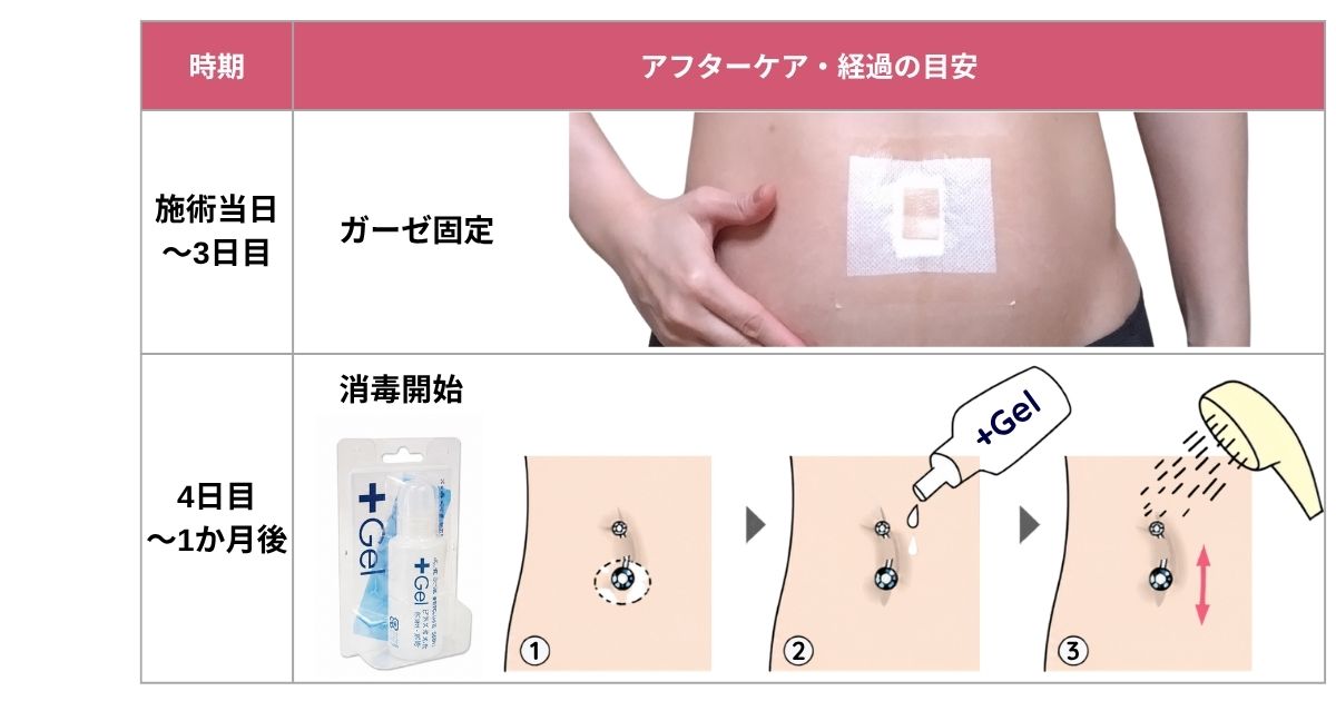 アフターケア
