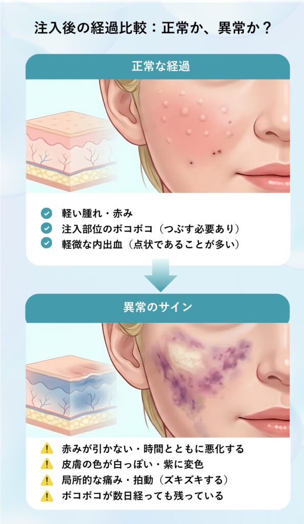 スキンバイブの注入経過比較