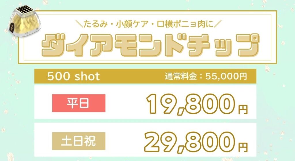 ポテンツァ　ダイヤモンドチップ　料金表