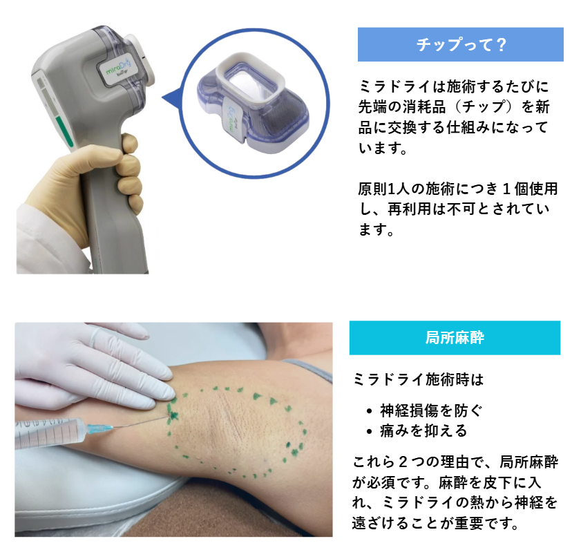 ミラドライのチップ、局所麻酔に関する説明