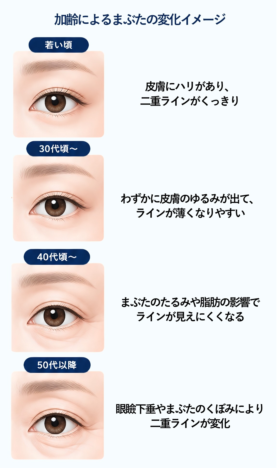 加齢によるまぶたの変化イメージ