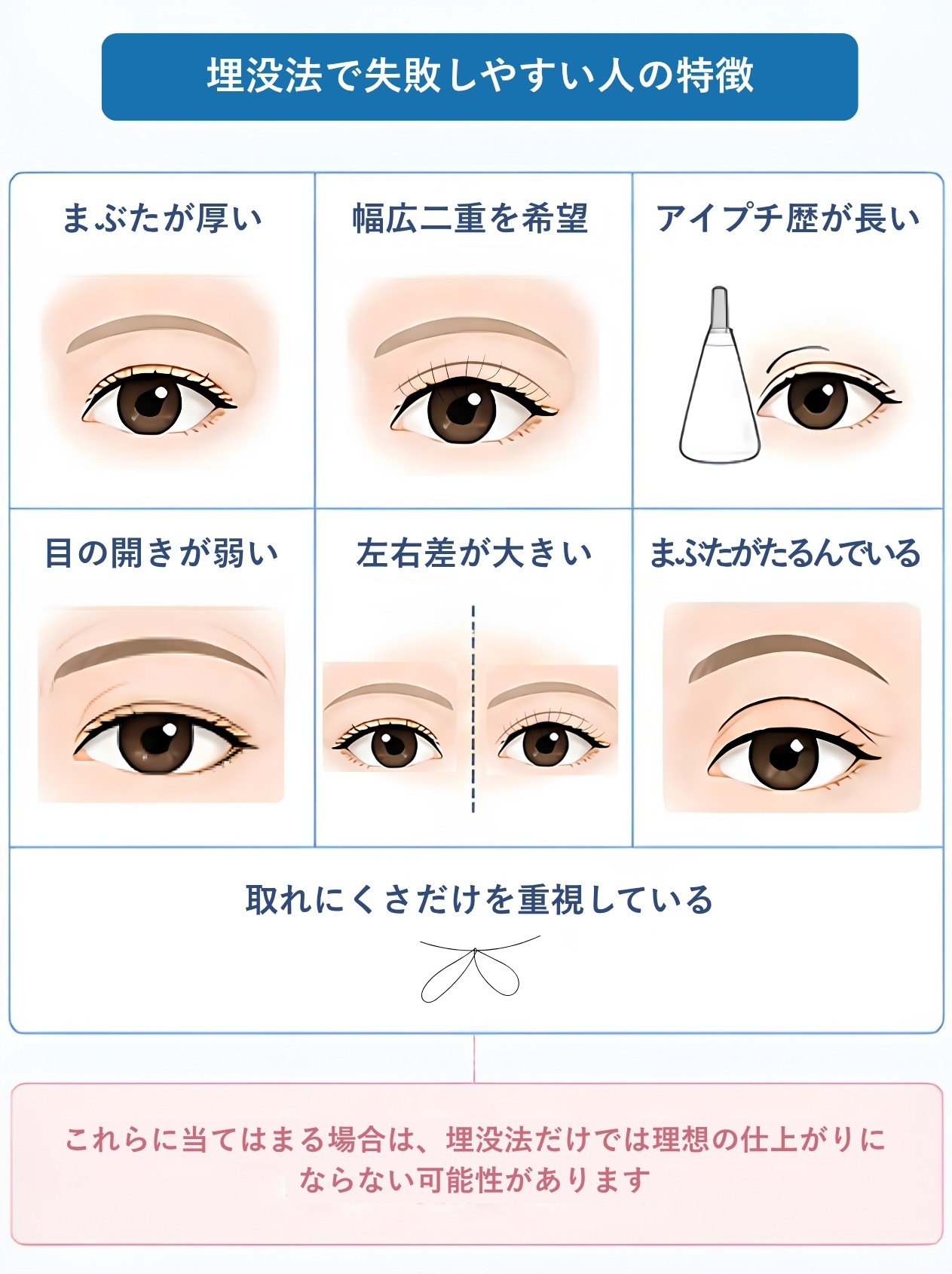 埋没法で失敗しやすい人の特徴