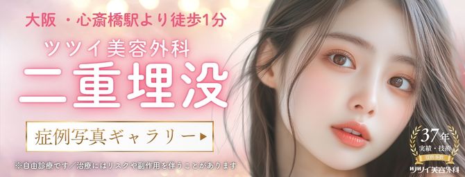 ツツイ美容外科の埋没症例ギャラリー