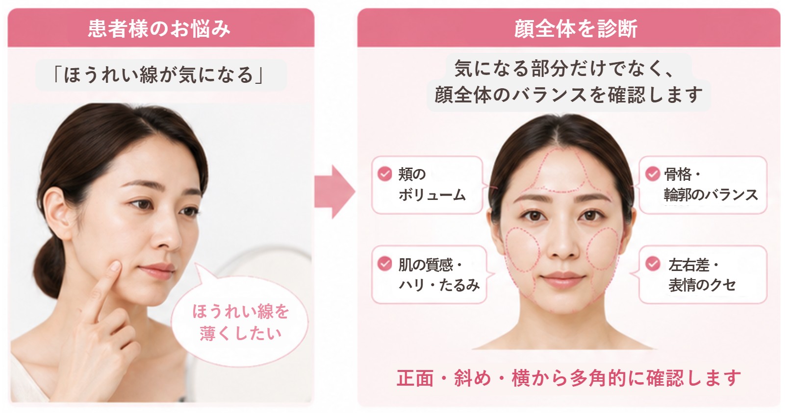 ヒアルロン酸注入箇所の判断