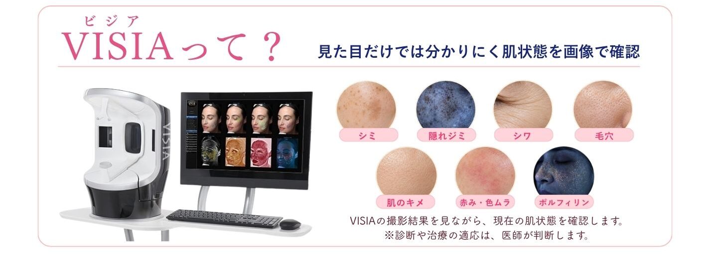 VISIAって?