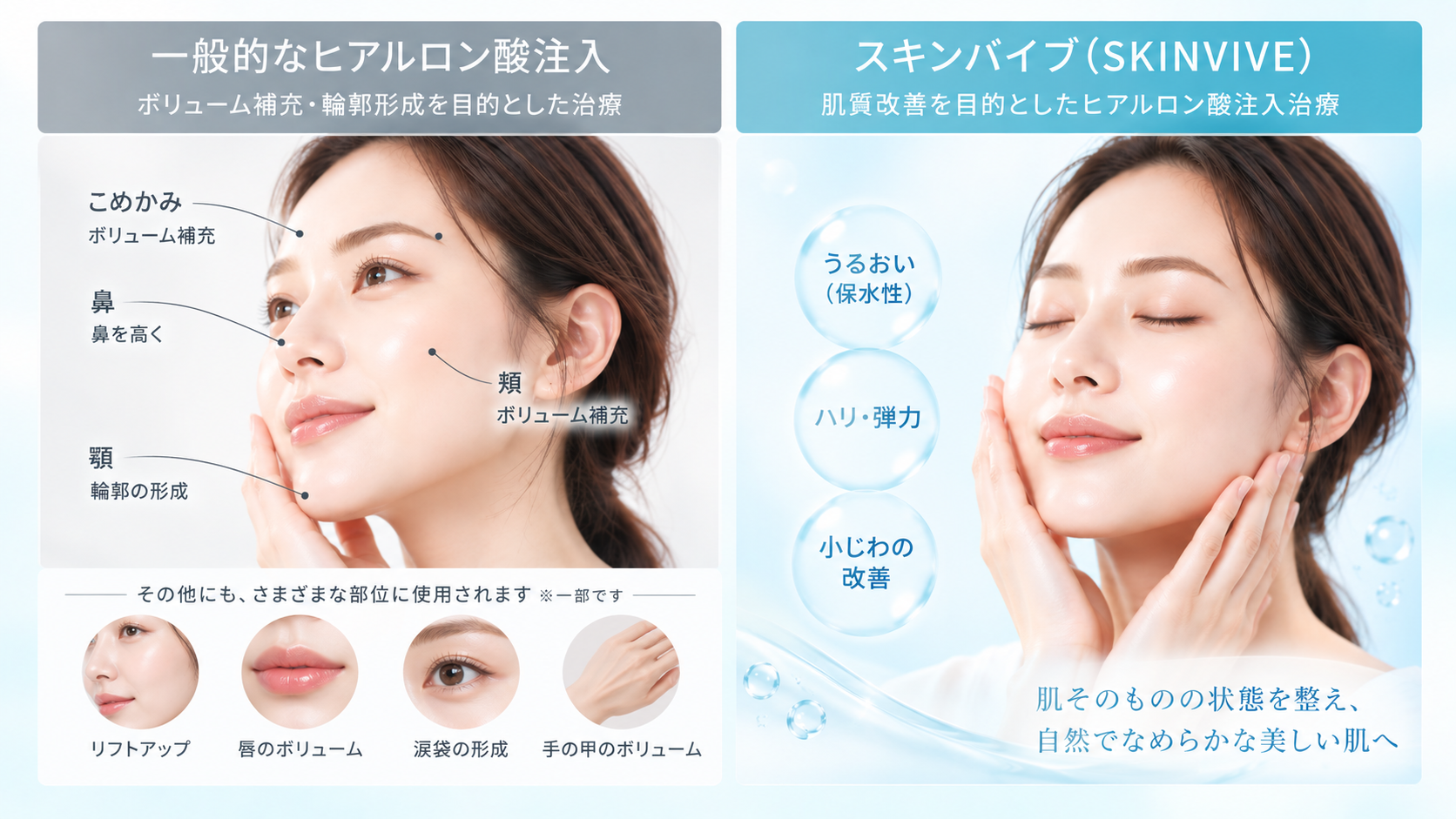 一般的なヒアルロン酸とスキンバイブ(SKINVIVE)の違い