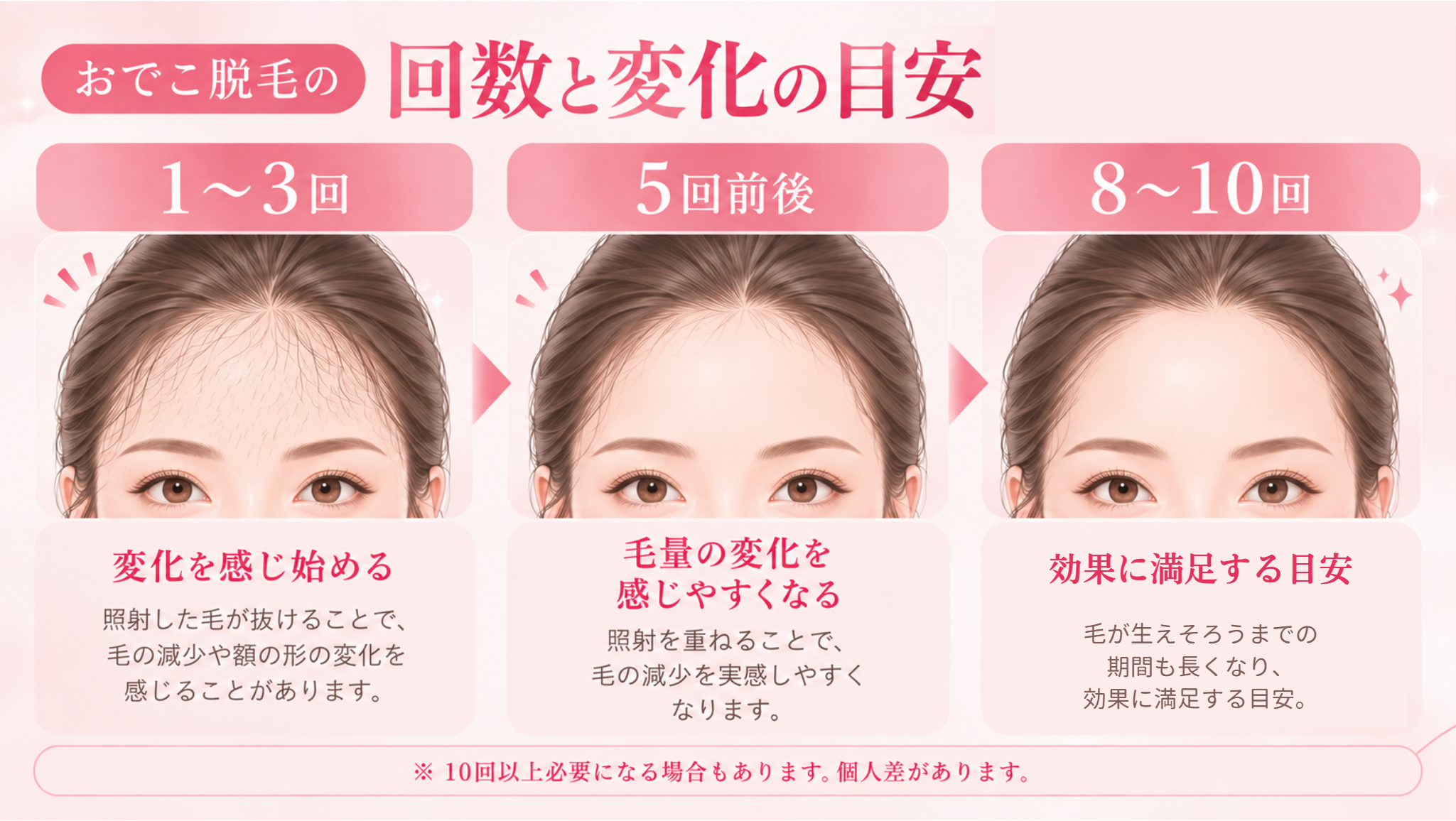 おでこ脱毛の回数と変化の目安