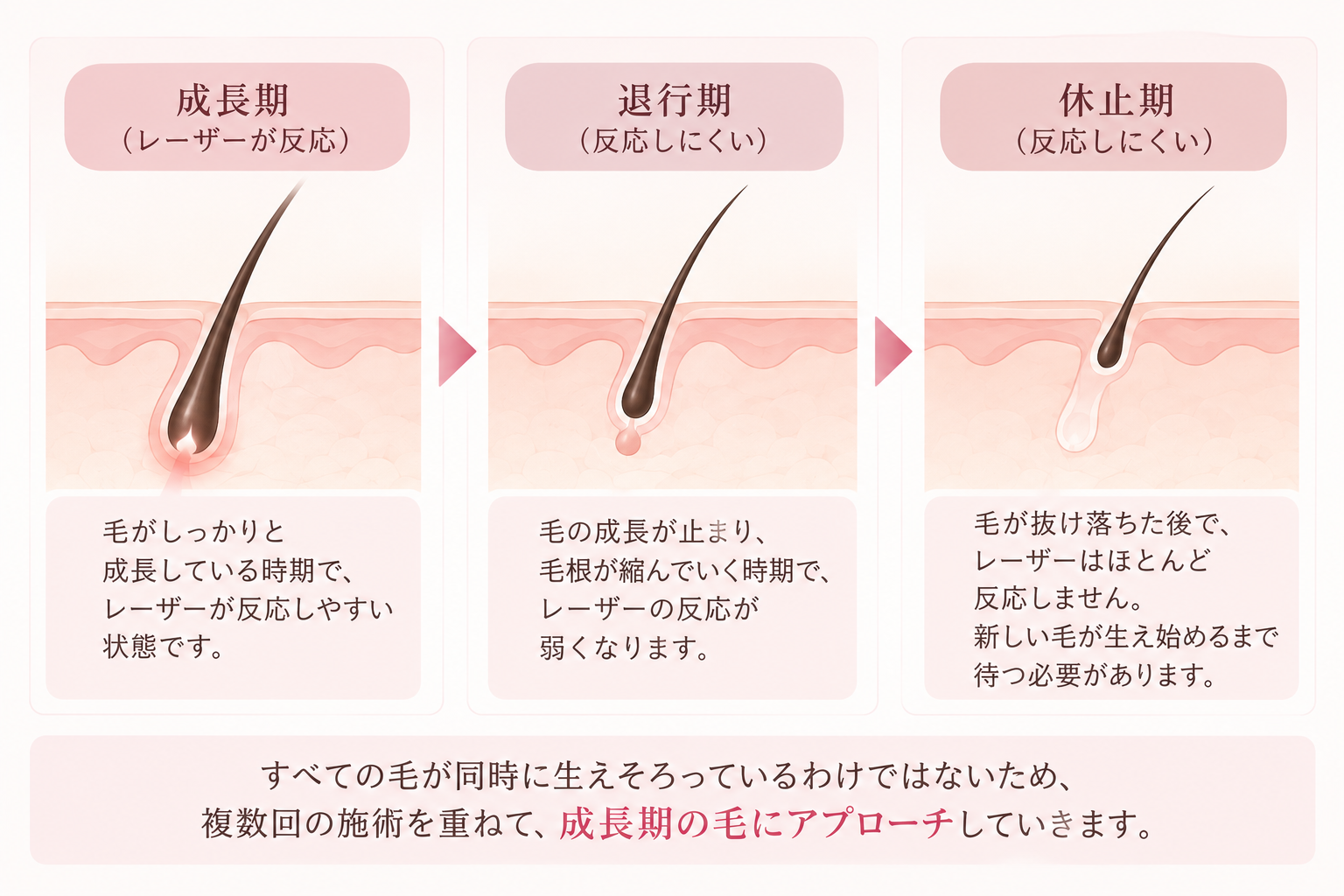 毛質・毛周期による違い