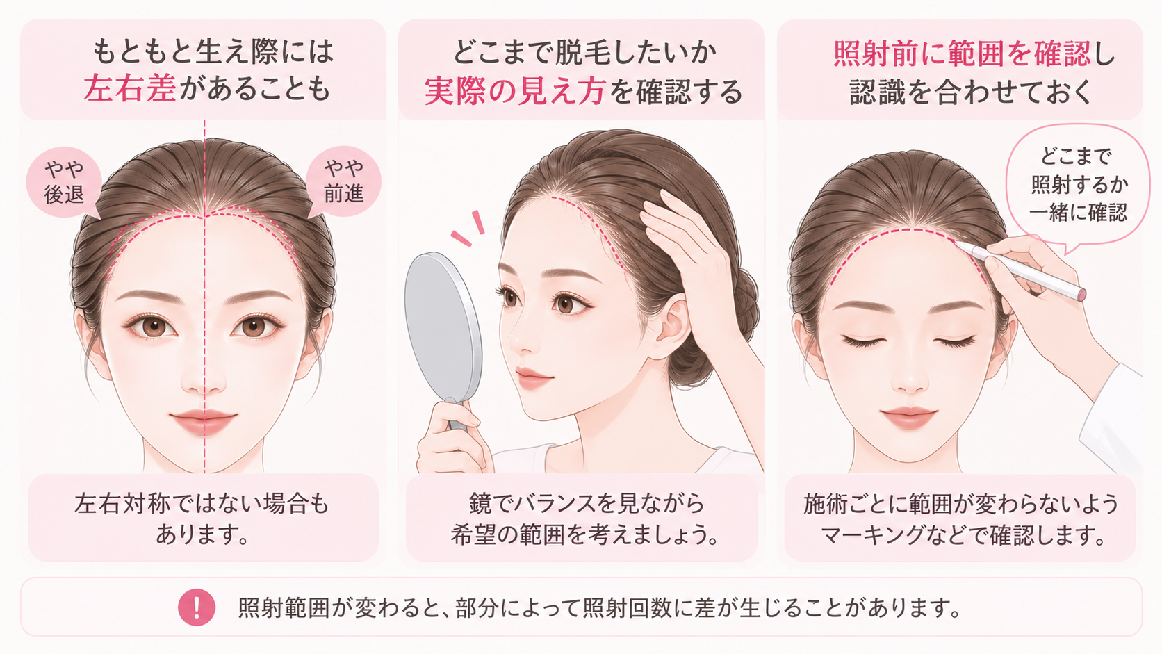 広げすぎ・左右差を防ぐために照射範囲を確認する