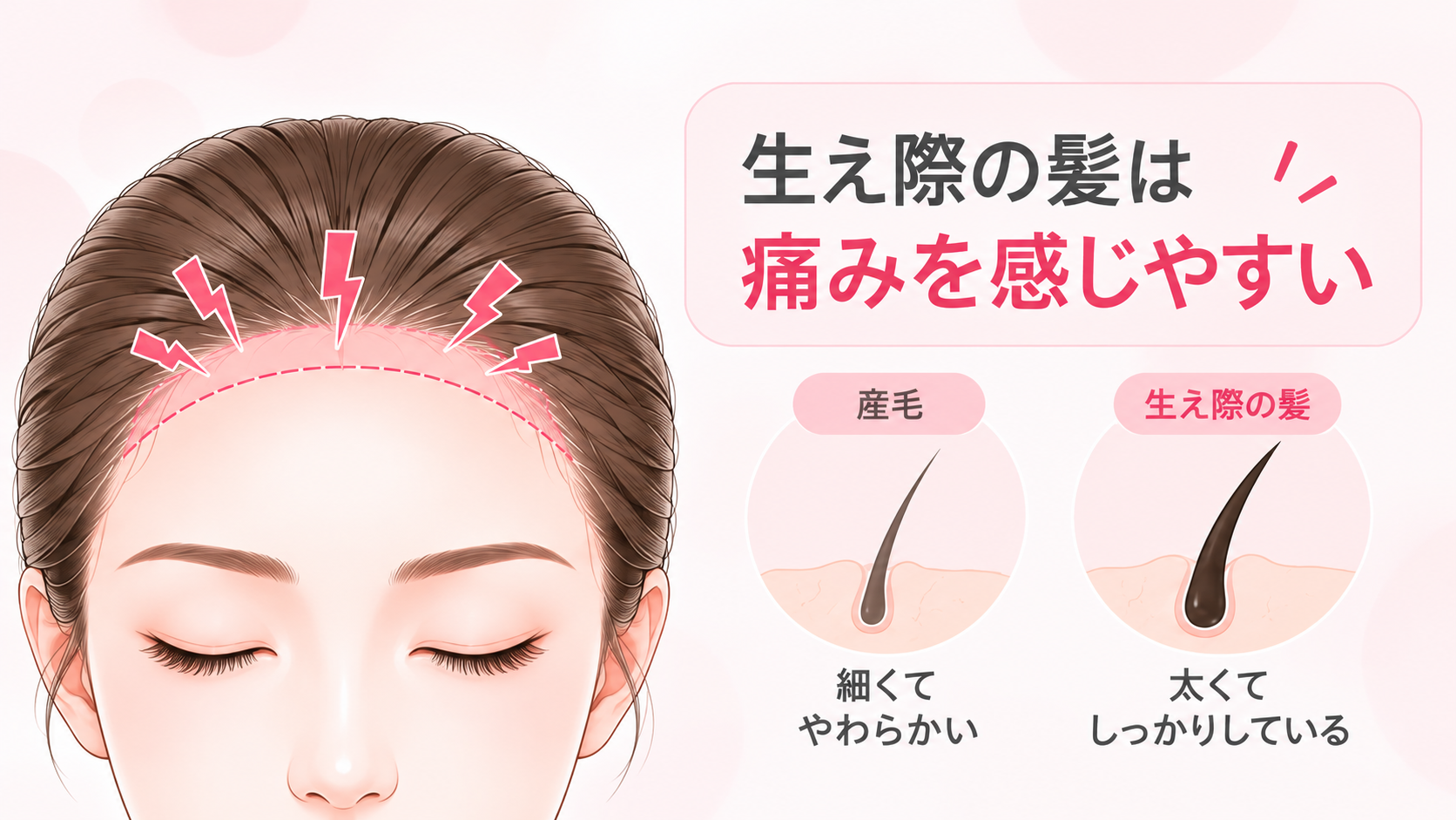 生え際の髪は痛みを感じやすい