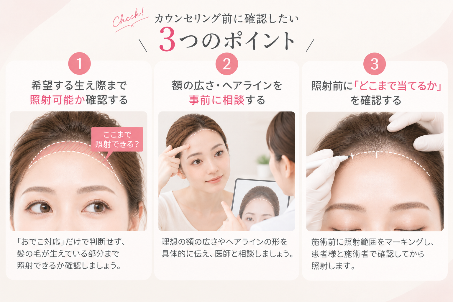 おでこ脱毛で希望するヘアラインを目指すための3つのポイント