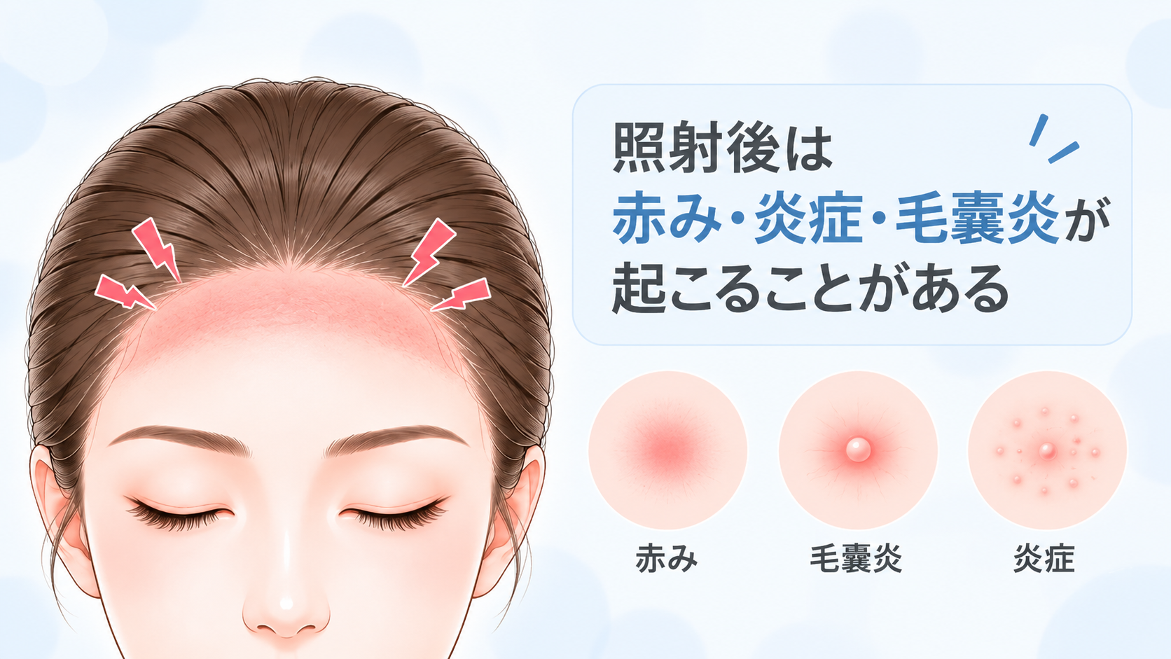 赤み・乾燥・ヒリつきなど施術後の症状