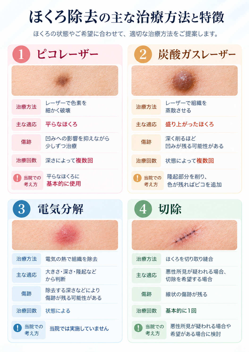 ほくろ除去の主な治療法と特徴