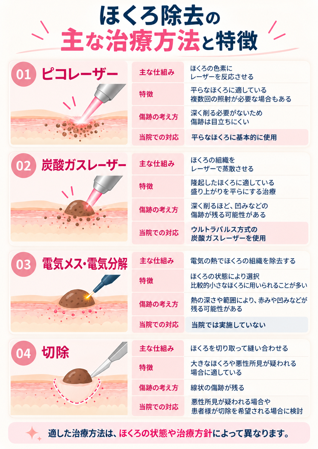 ほくろ除去の主な治療方法と特徴
