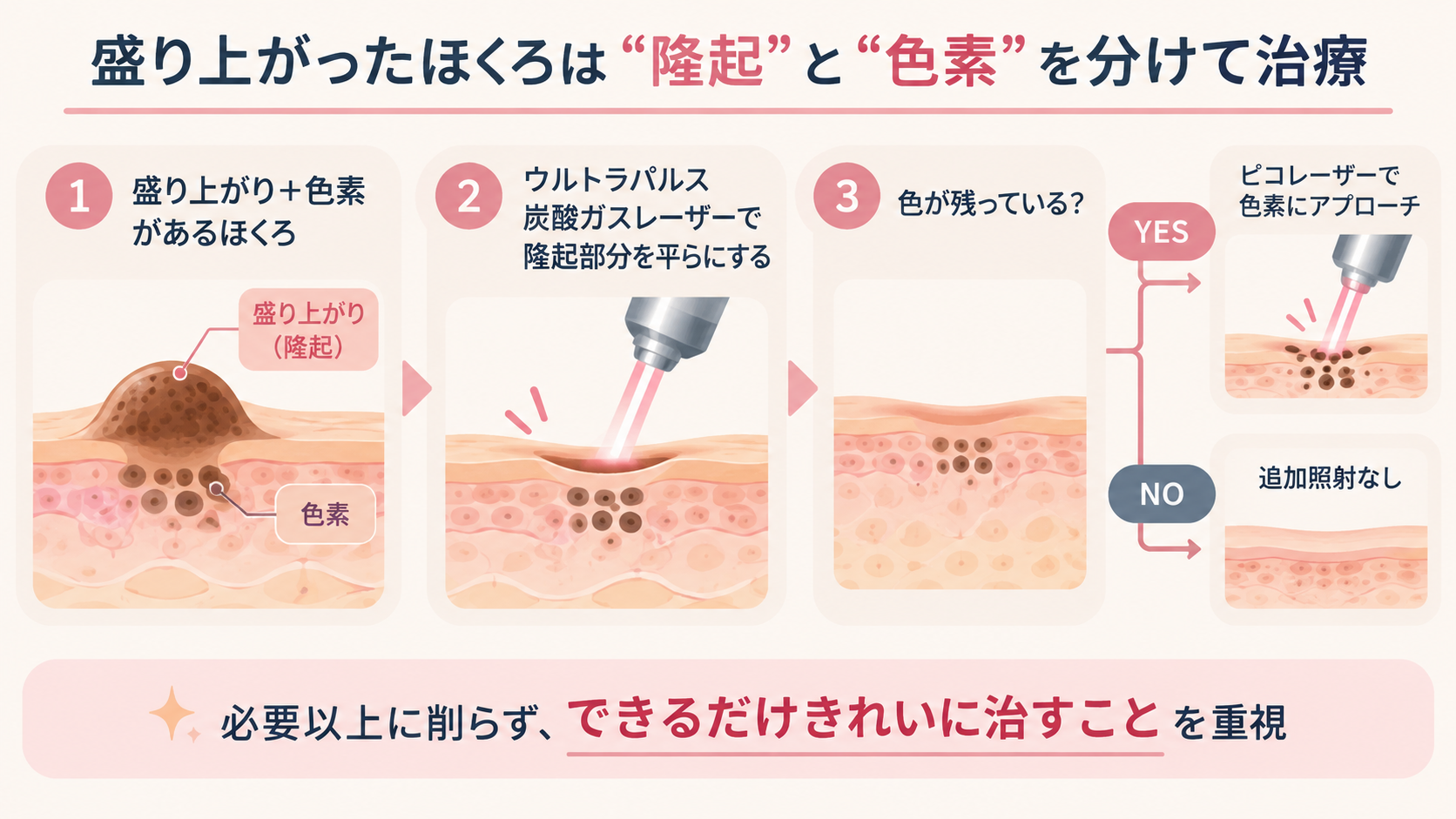 盛り上がったほくろは“隆起”と“色素”を分けて考える
